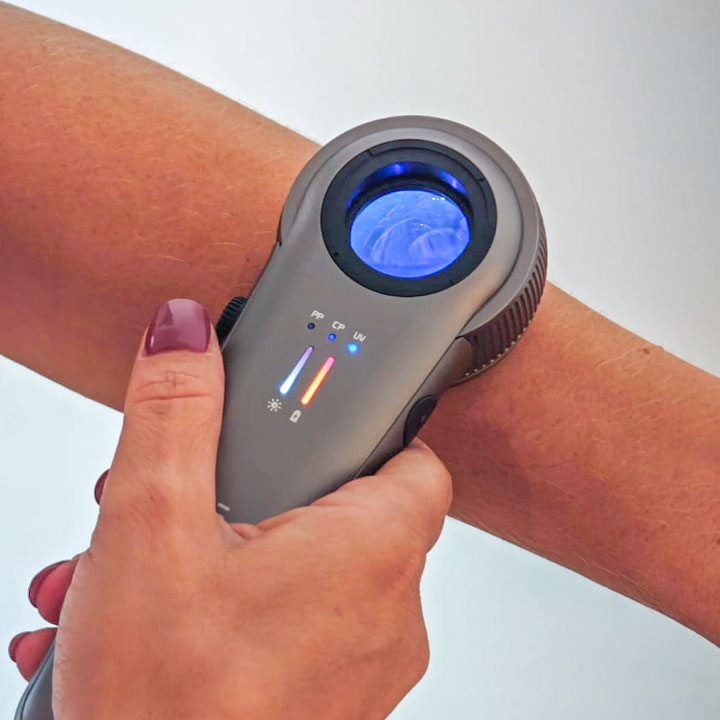 Illuco IDS-9110: il nuovo dermatoscopio digitale disponibile in Italia