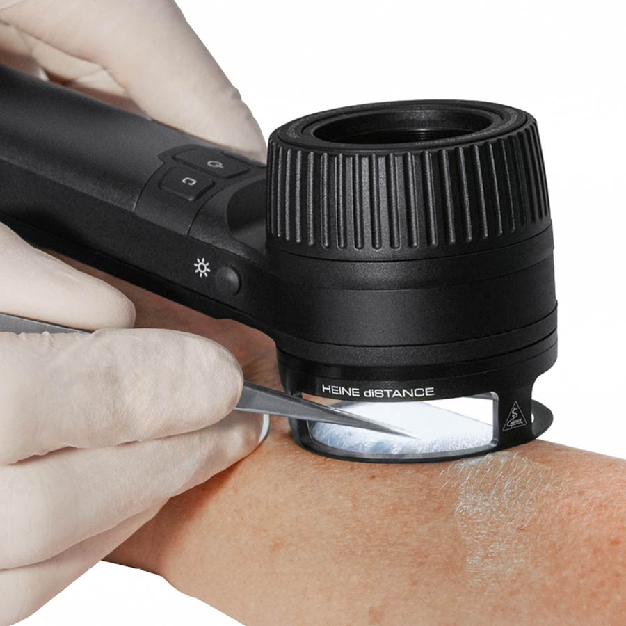 Delta 30 Pro vs DermLite DL5: quale dermatoscopio scegliere nel 2026?