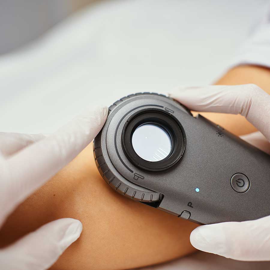 Dermatoscopio Illuco IDS 1100