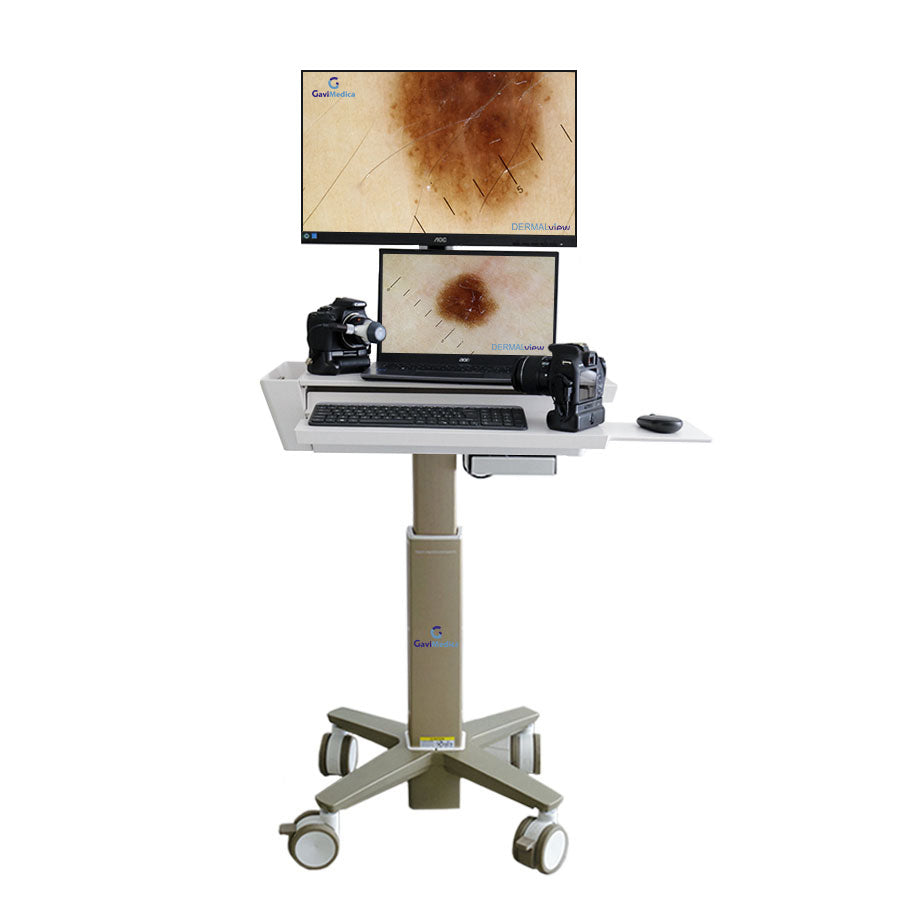 Videodermatoscopio DERMALview Laptop