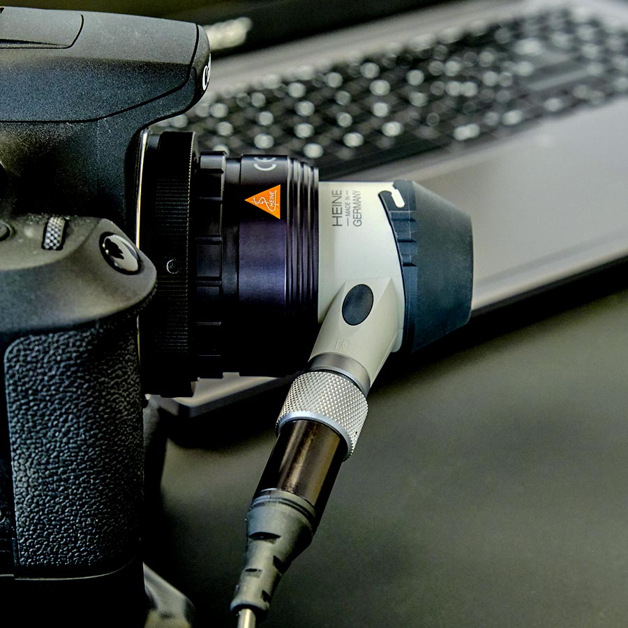 Videodermatoscopio DERMALview Portable