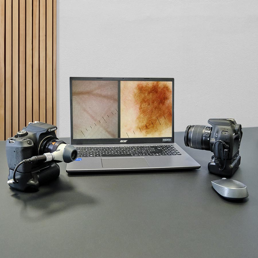 Videodermatoscopio DERMALview Portable