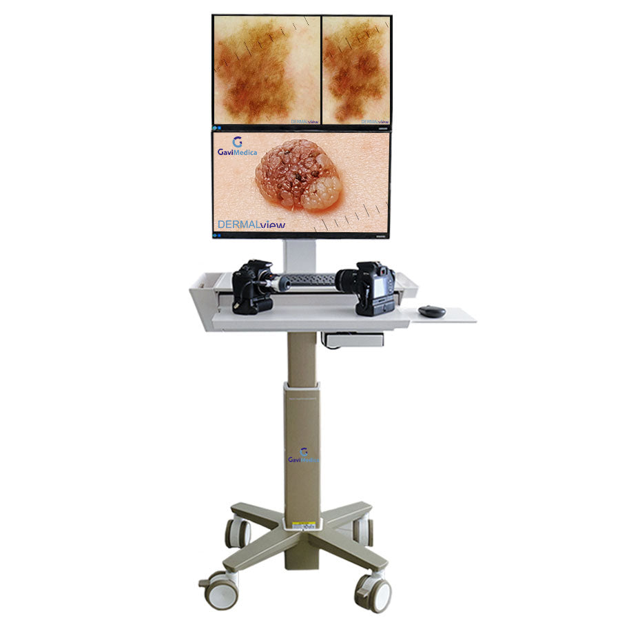Videodermatoscopio DERMALview Vertical